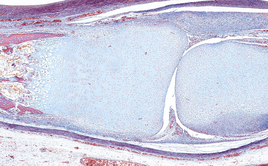 Image 1 - interphalangeal joint