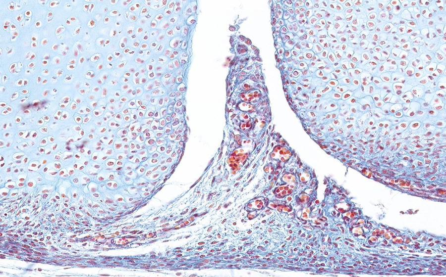 Image 2 - joint