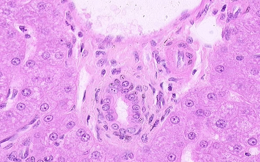 Liver