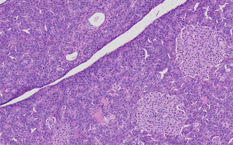Pancreas
