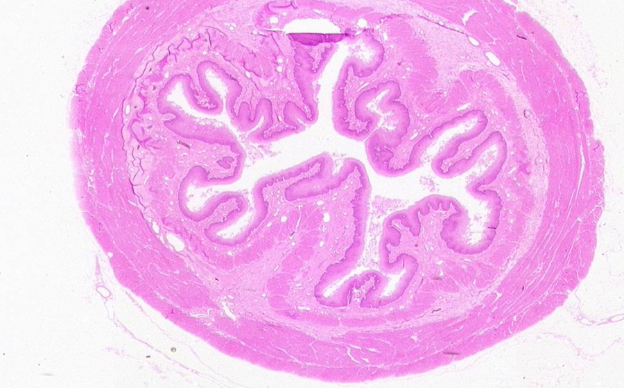 Esophagus