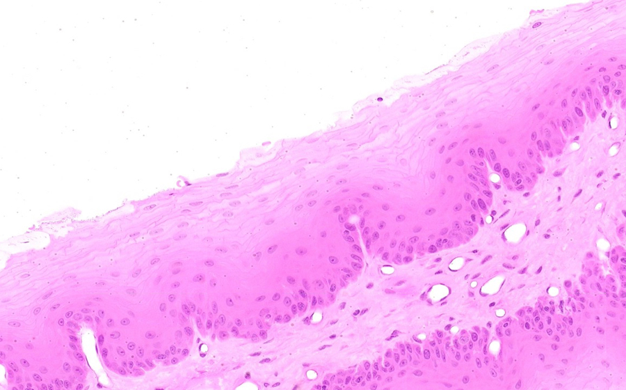 Esophagus