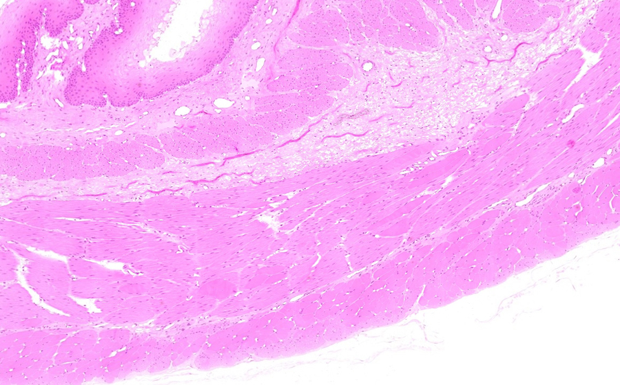 Esophagus