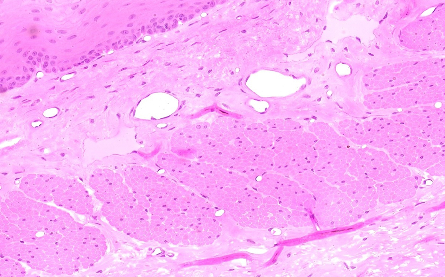 Esophagus