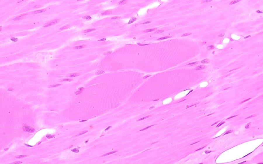 Esophagus