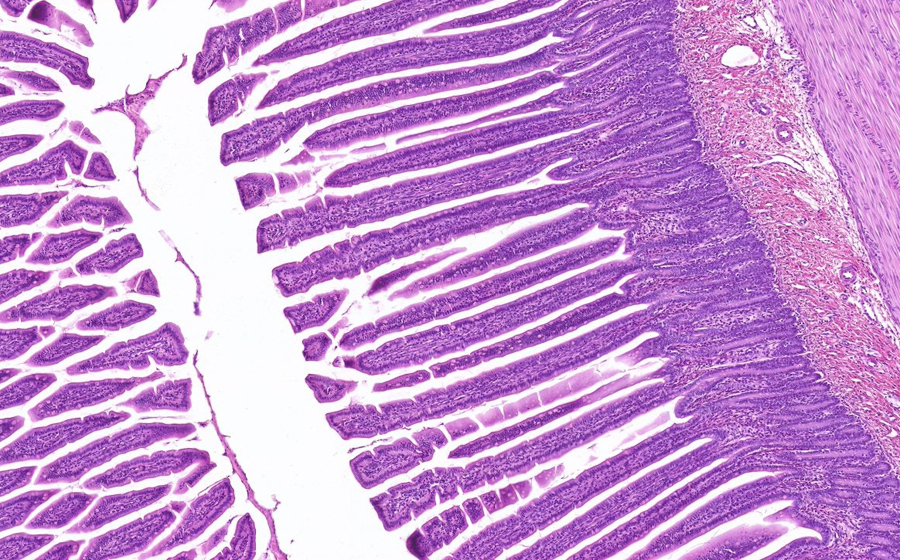 Small Intestine