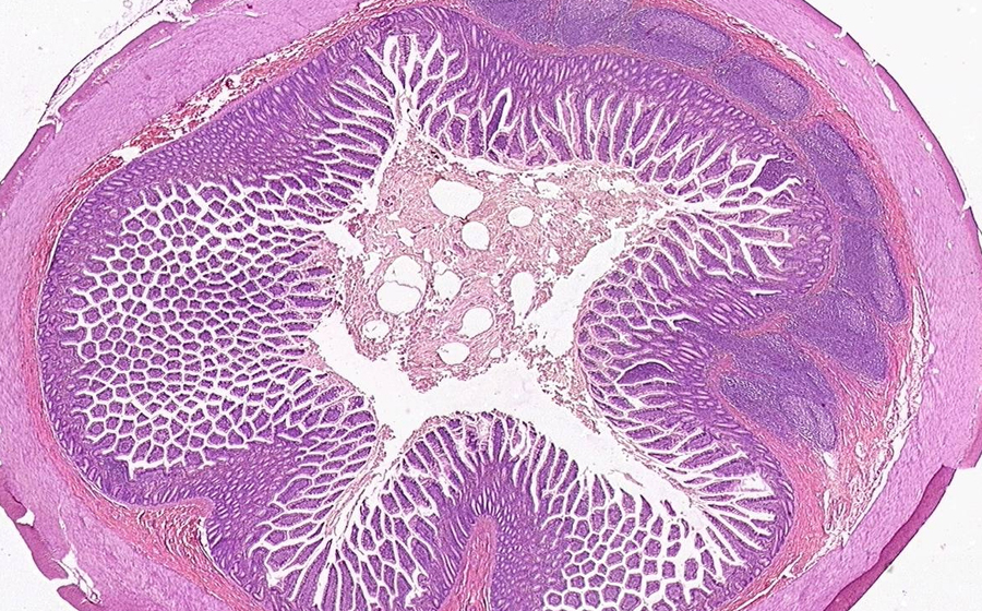 Small Intestine
