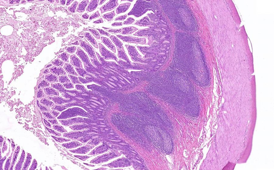 Small Intestine