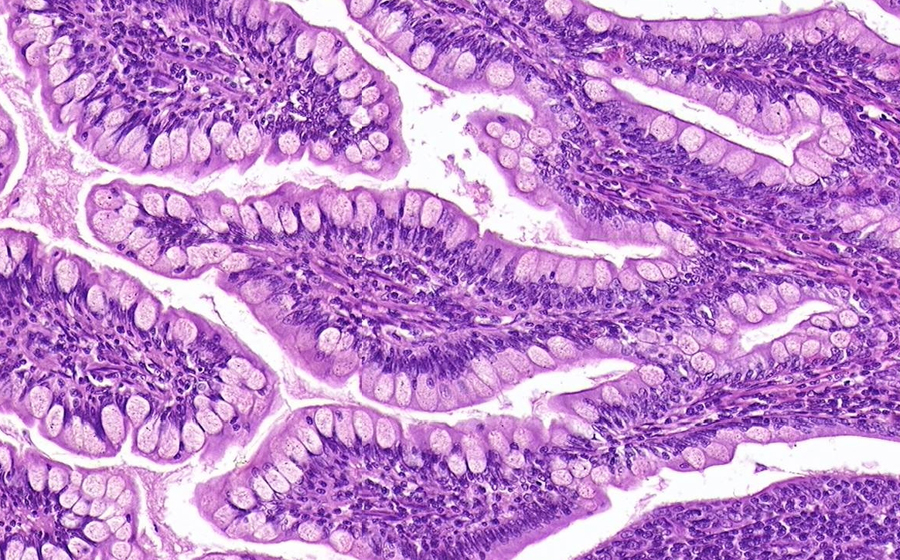 Small Intestine