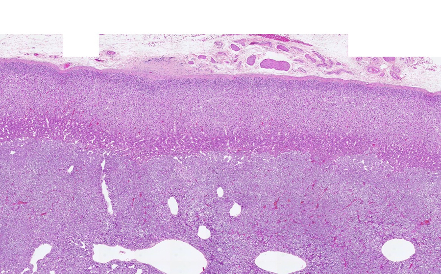 Adrenal