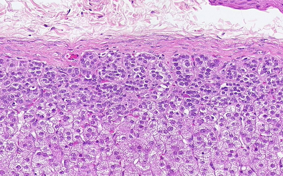Adrenal