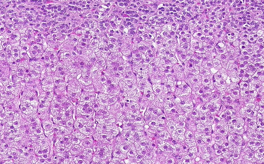 Adrenal