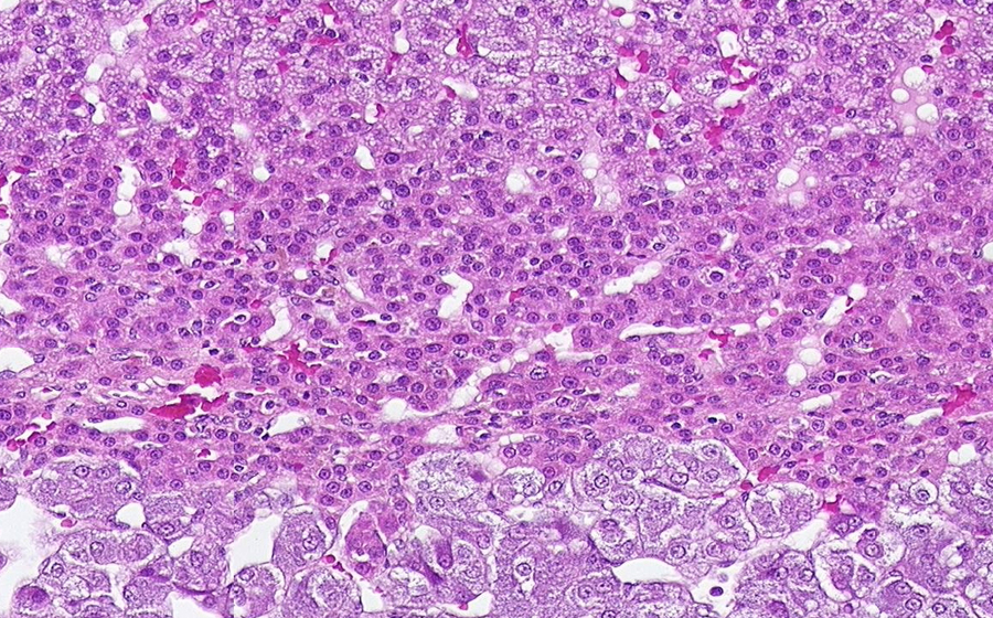 Adrenal