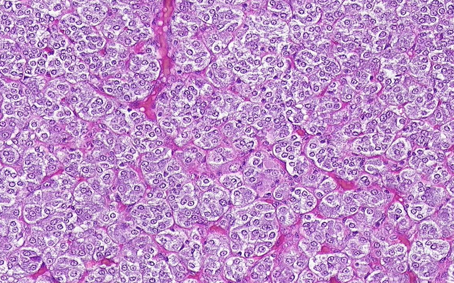 Adrenal