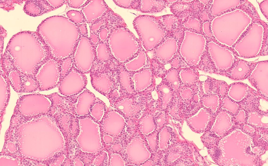 Thyroid