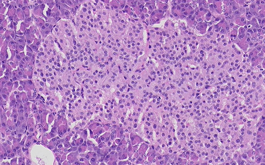Pancreas