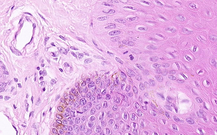 Ovary and Oviduct