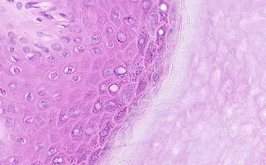 Ovary and Oviduct