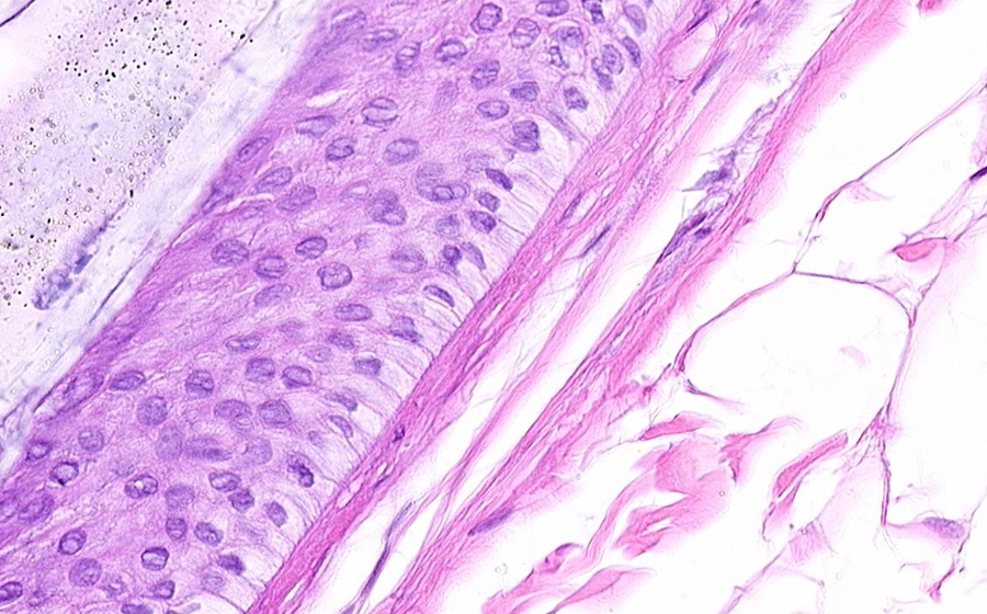 Ovary and Oviduct