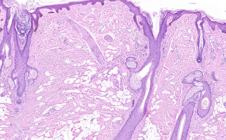 Liver