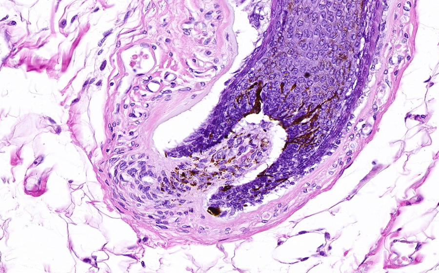 Liver