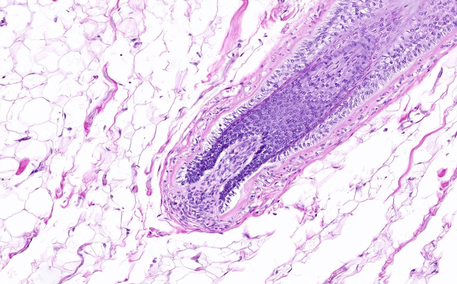 Liver