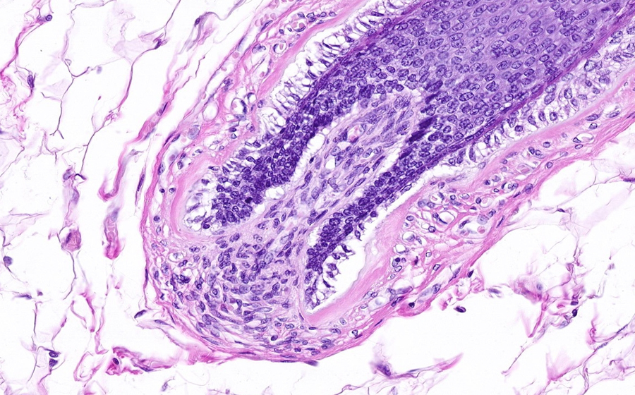 Ovary and Oviduct