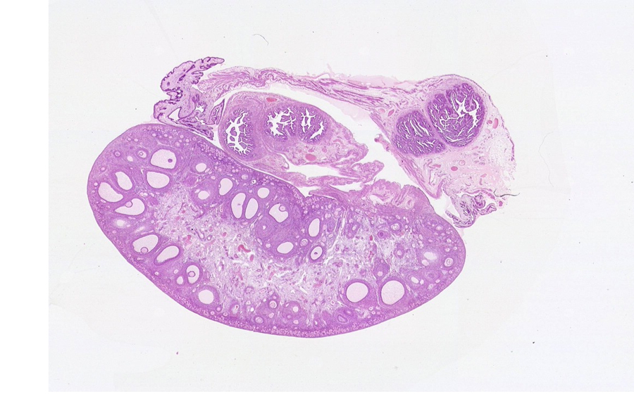 Ovary and Oviduct