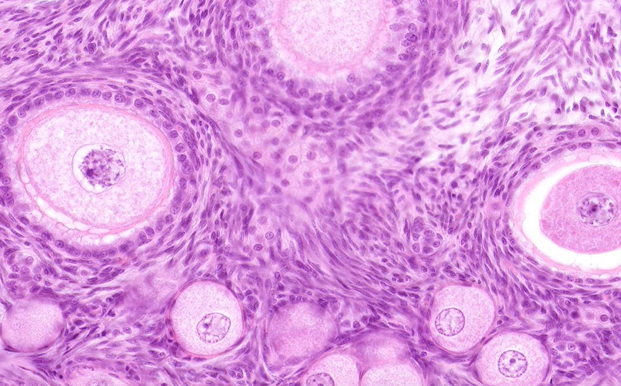 Ovary and Oviduct