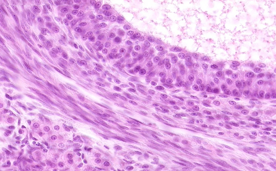 Ovary and Oviduct