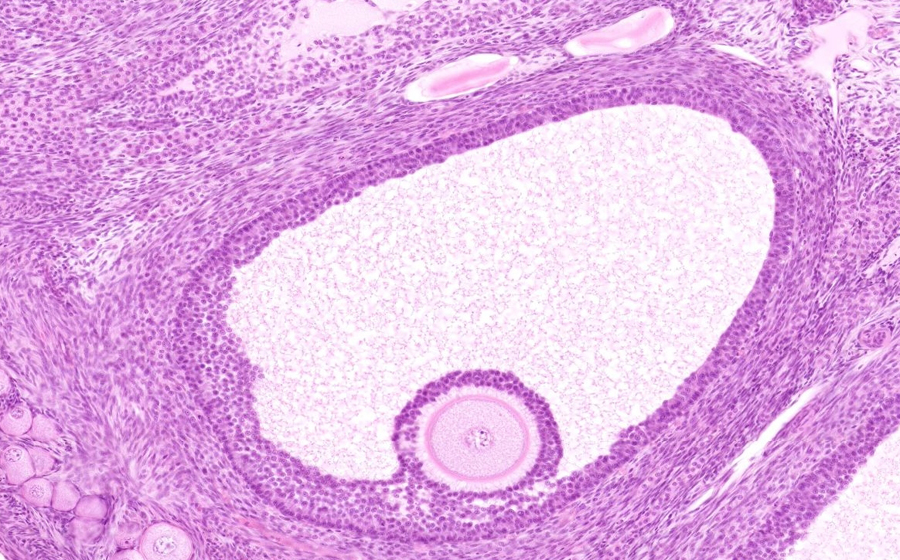 Ovary and Oviduct