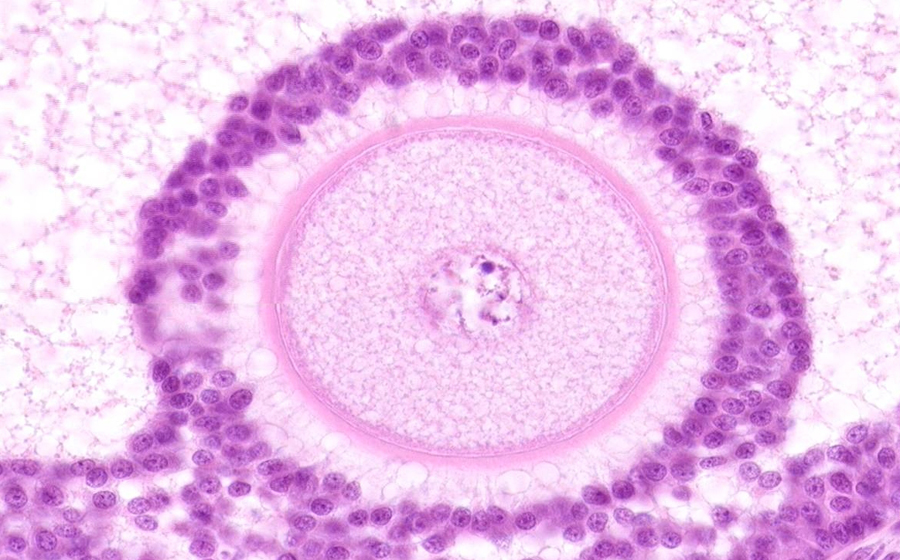 Ovary and Oviduct