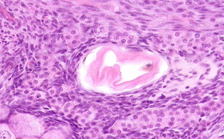 Ovary and Oviduct