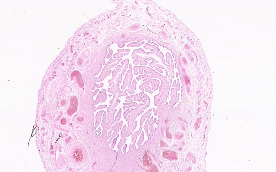 Oviduct