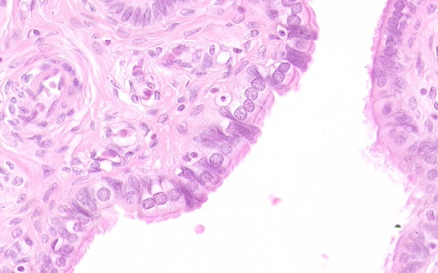 Oviduct