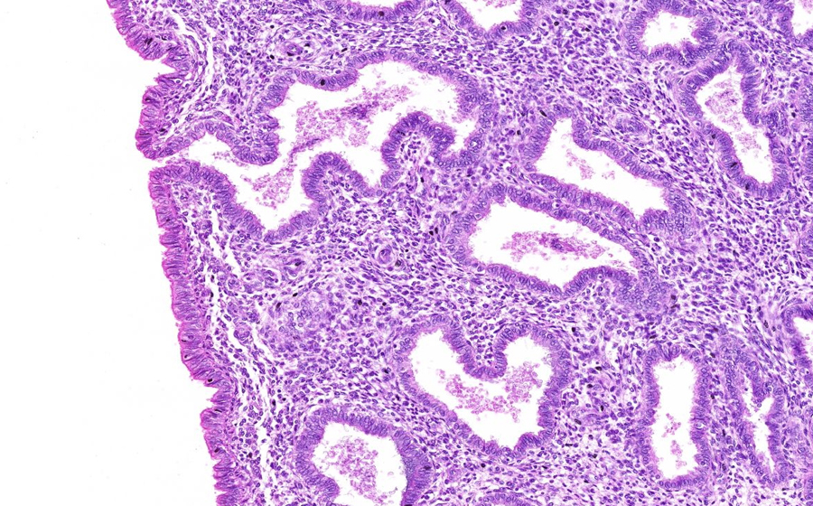 Uterus