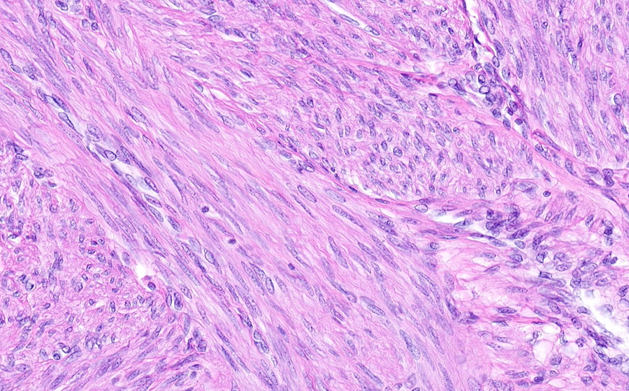 Uterus