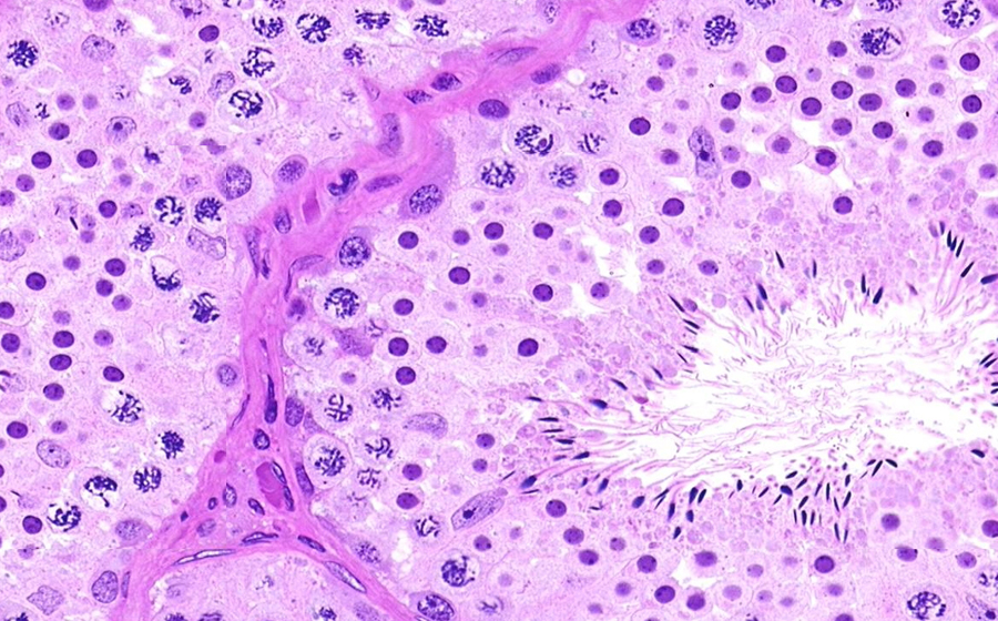 Ovary and Oviduct