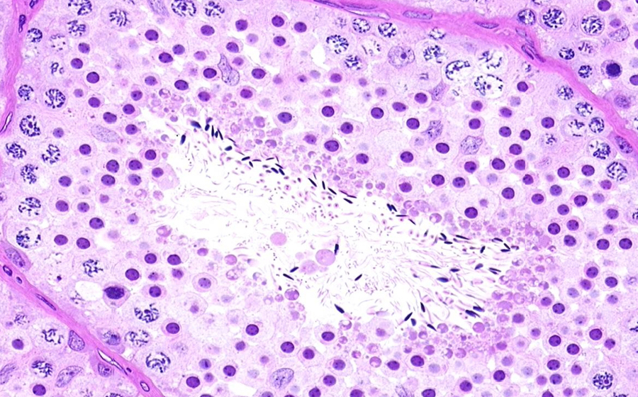 Ovary and Oviduct