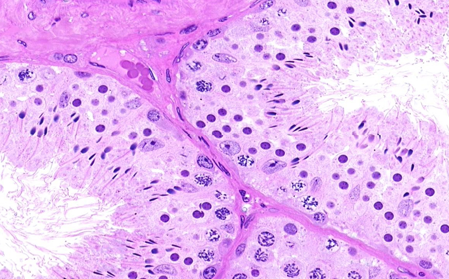 Ovary and Oviduct