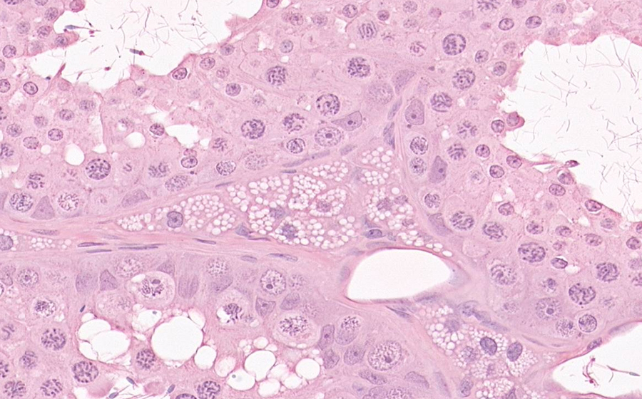 Ovary and Oviduct