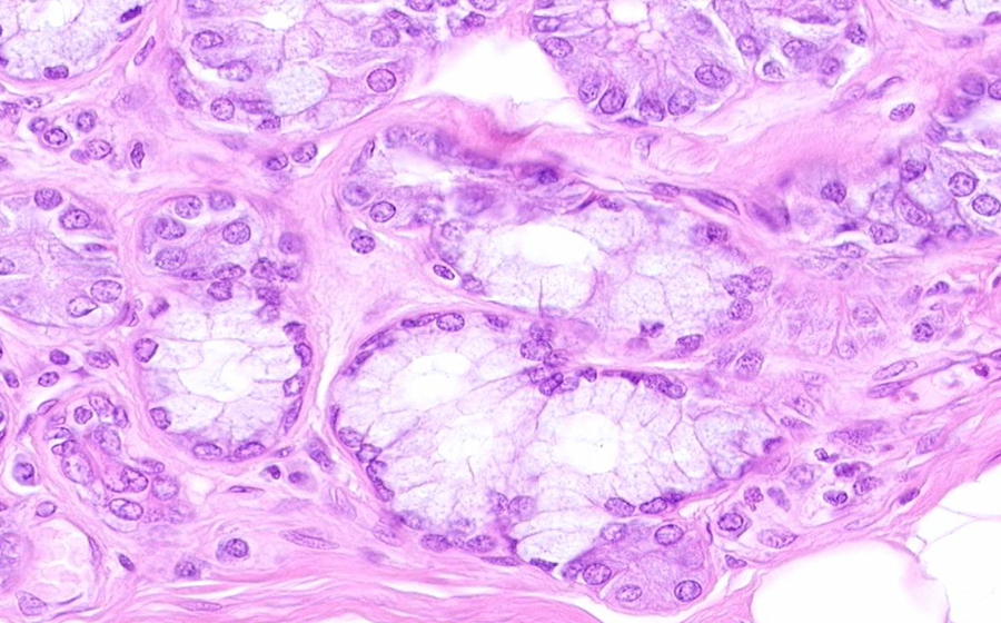 Trachea