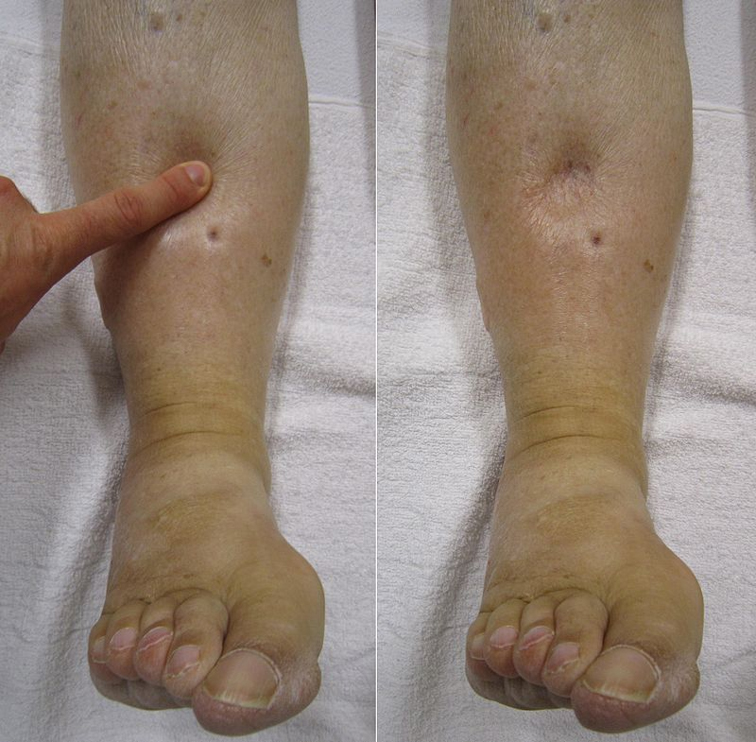 Case 3- Image 1