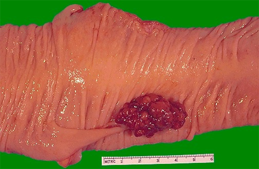 Liver