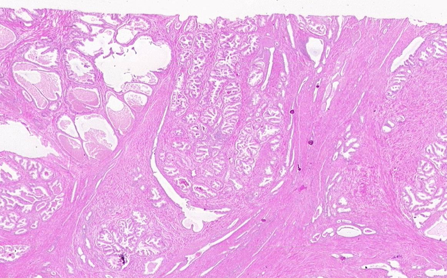 Slide 1 - Image 3