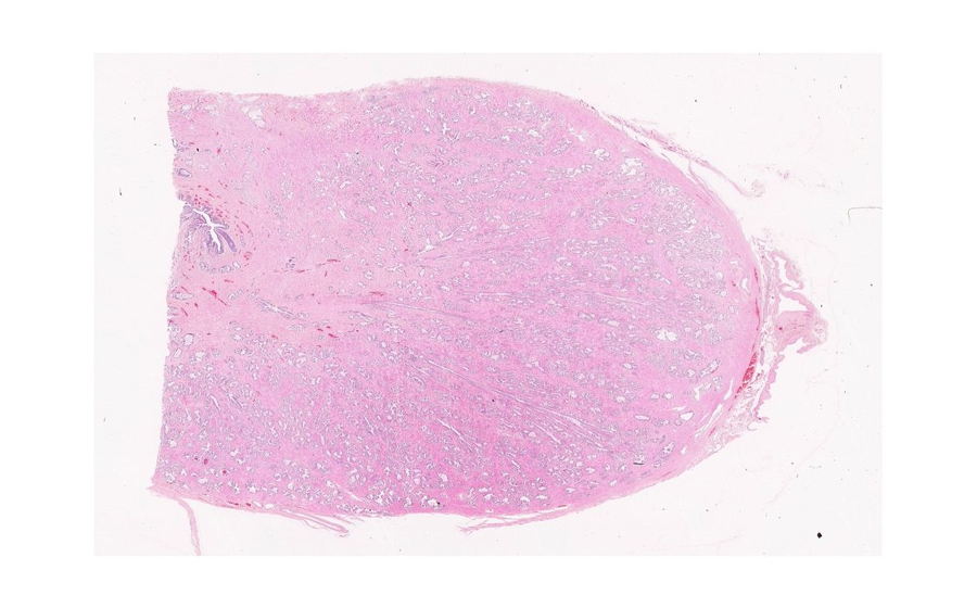 Normal Image 1