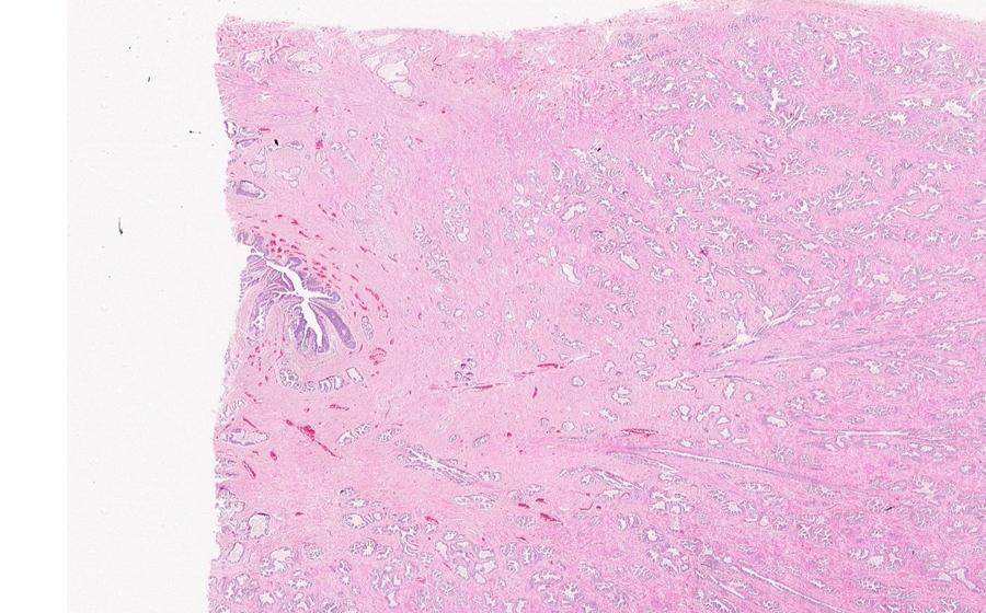 Normal Image 2