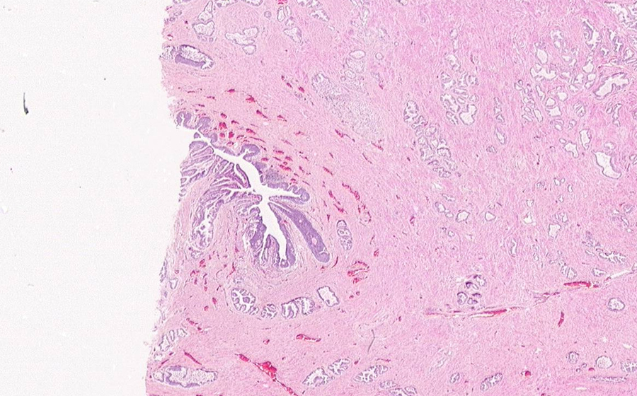 Normal Image 3