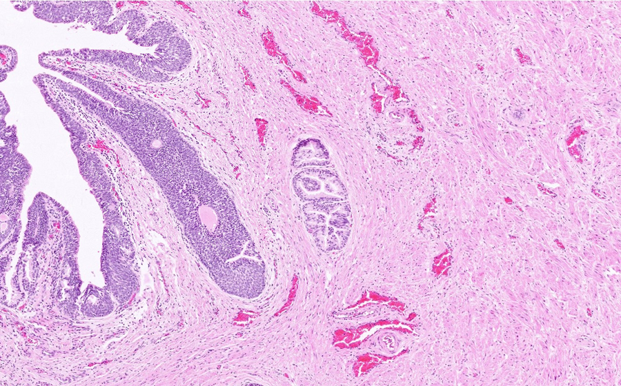 Normal Image 4