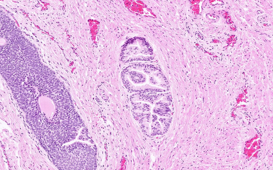 Normal Image 5